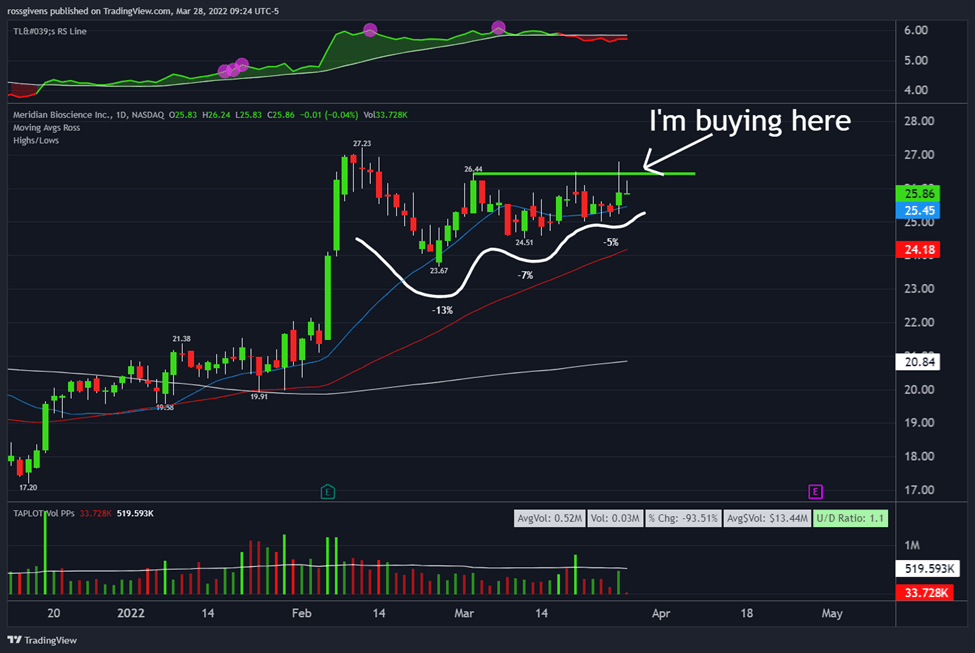 Here’s Where I’m Buying Meridian Bioscience Stock