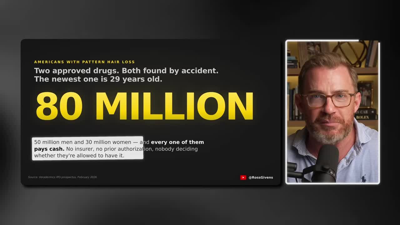 Stat graphic showing 80 million Americans with pattern hair loss - 50 million men and 30 million women, all paying cash for treatment