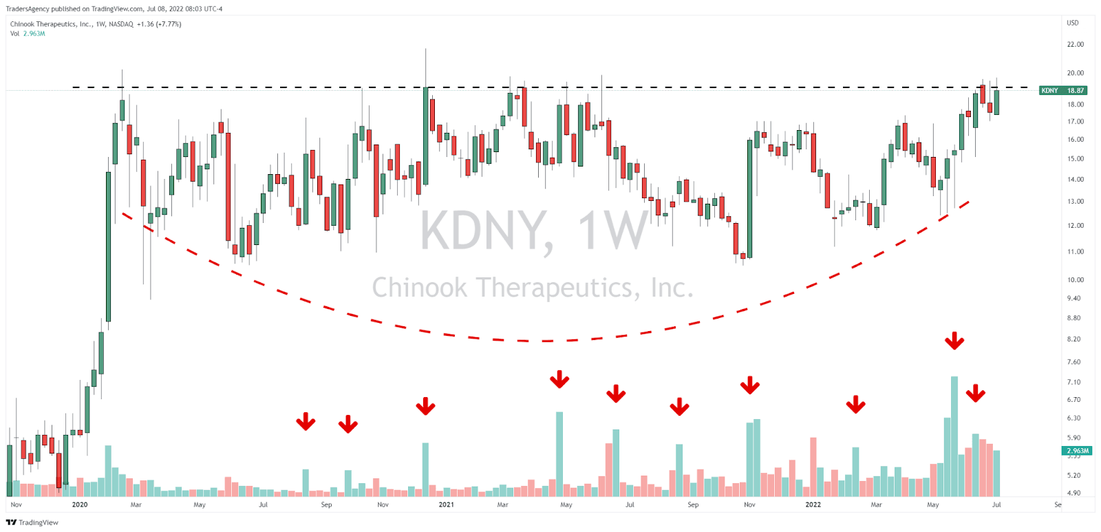 With a Setup Like This, I’m Expecting Big Things From Chinook Therapeutics